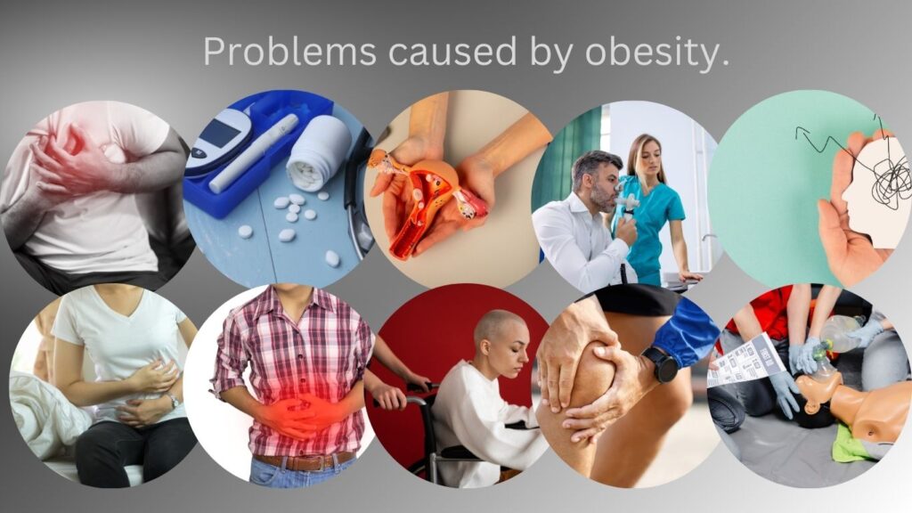 10 problem caused by obesity