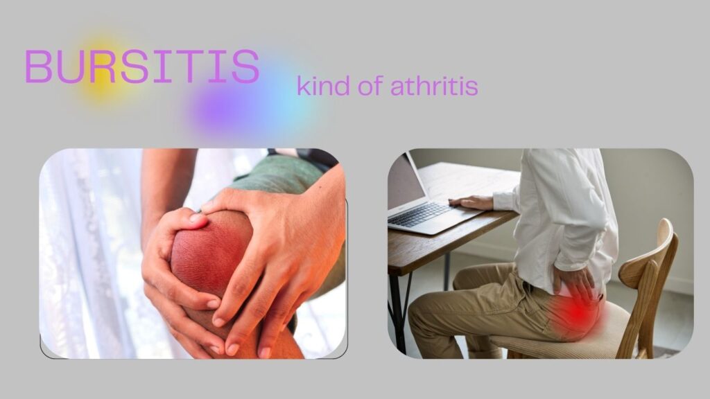 A picture by 5 top symptoms of hip pain with bursitis